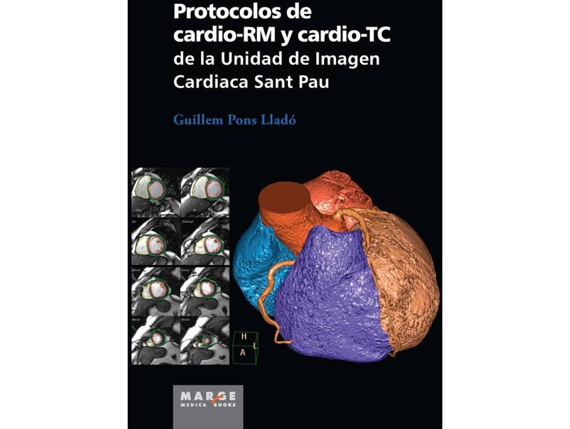 Libro Protocolos De Cardio-Rm de Albert Badia